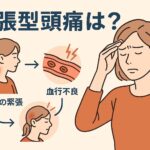 筋緊張性頭痛の女性