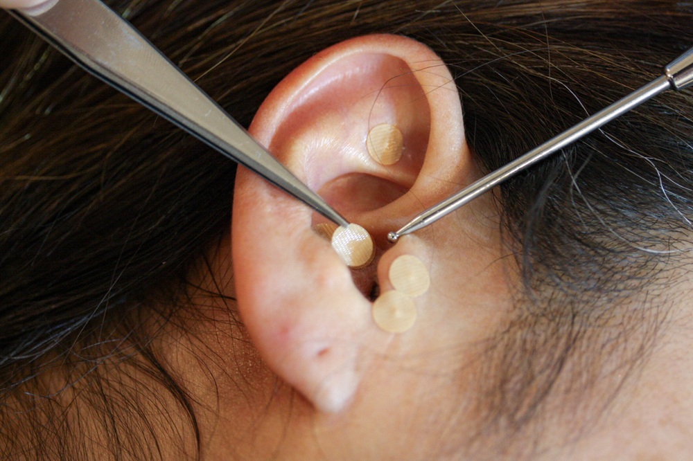 耳つぼダイエット